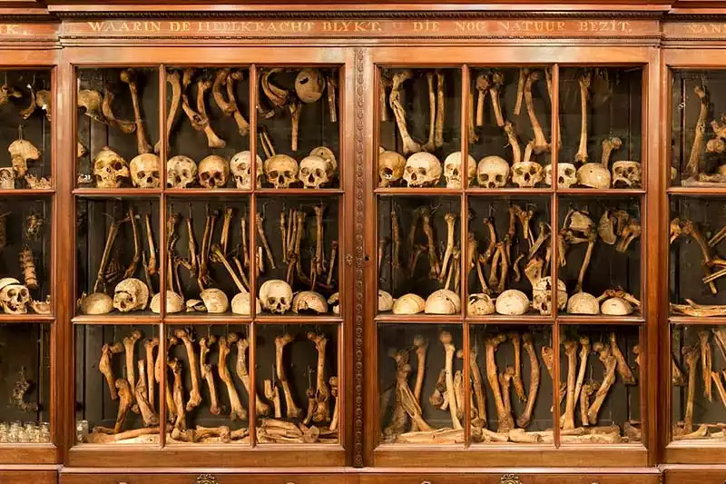 Vrolik Museum Amsterdam Skeletons